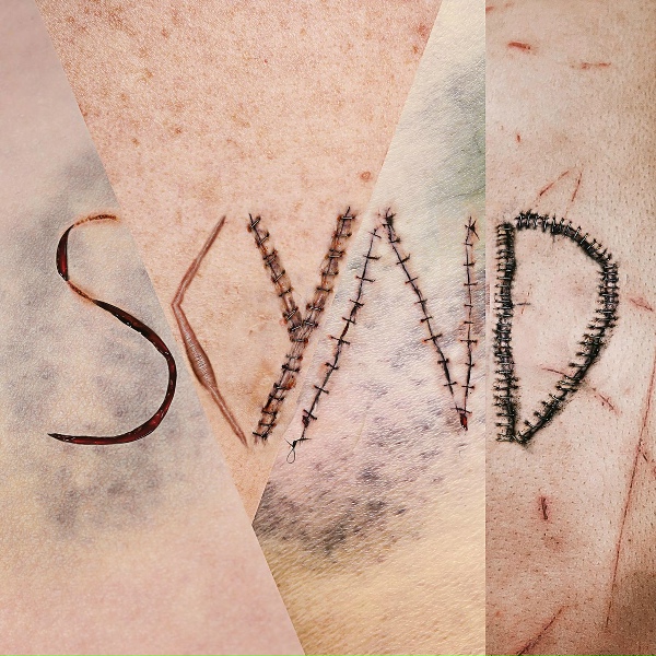 SKYND feat. Jonathan Davis