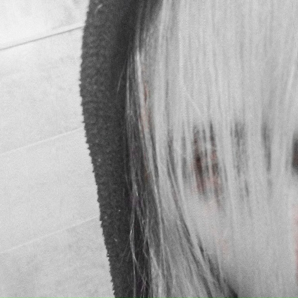 Psychosis